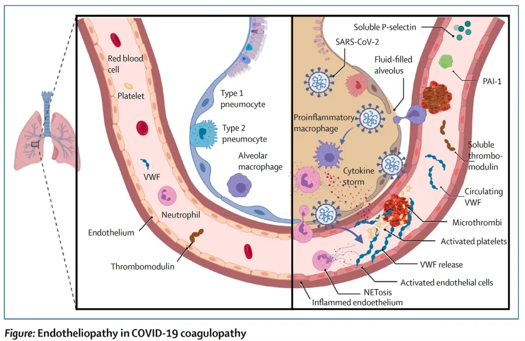 Covid en aderen, PAIS